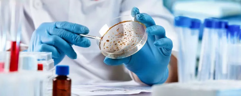 ANÁLISES MICROBIOLÓGICAS EM COSMÉTICOS ANÁLISES MICROBIOLÓGICAS EM COSMÉTICOS