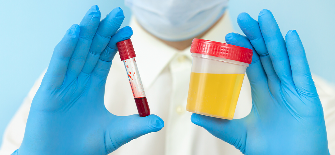 NR-7 e as Análises Toxicológicas NR-7 e as Análises Toxicológicas